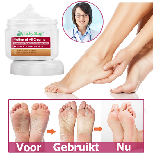 ItchyStop™ | Crème voor de behandeling van multi-symptomatische psoriasis