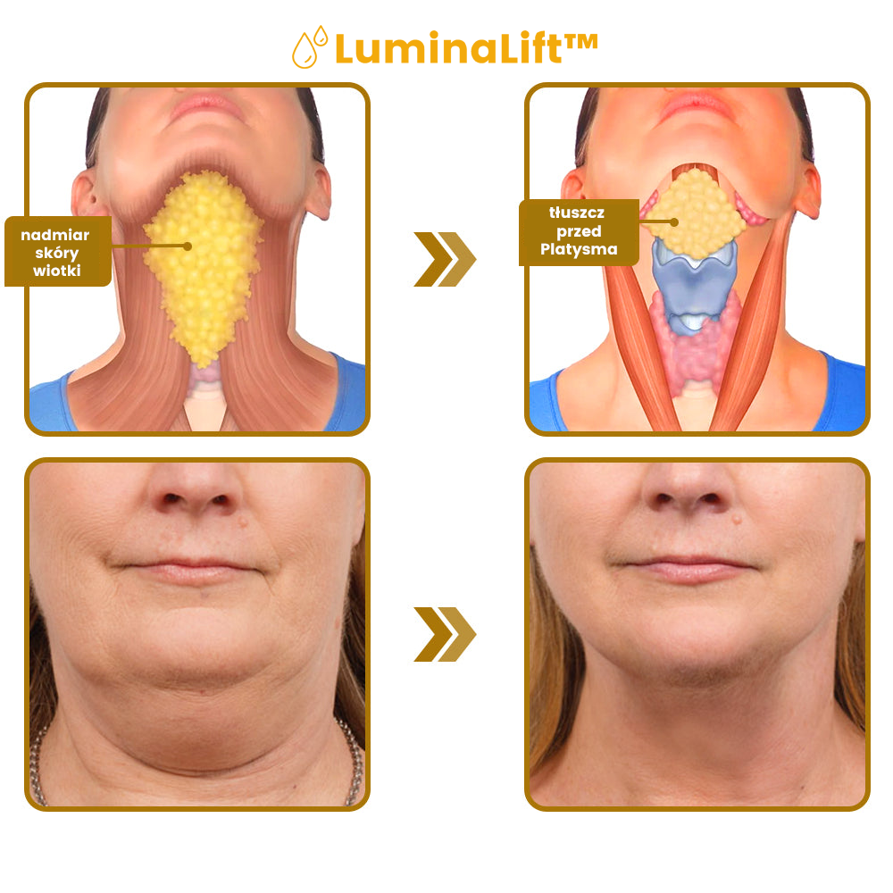 LuminaLift™ | Siero viso Placenta V 