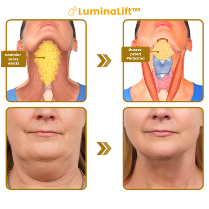 LuminaLift™ | Sérum visage Placenta V 