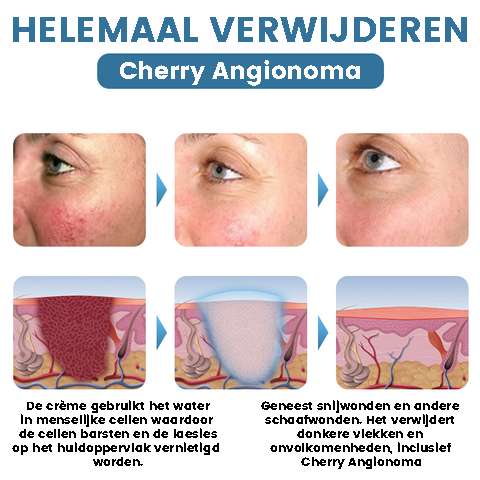 SpotErase™ | Petechiën Verwijderende Crème