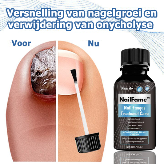 NailFame™ | Vloeistof voor de behandeling van nagelschimmel