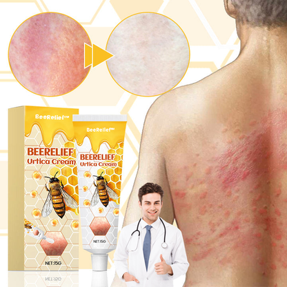 BeeRelief™ | Crème Urtique 