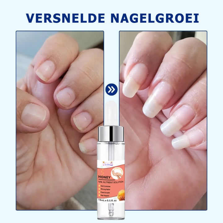 NailSaver™ | Krijg perfecte en gezonde nagels in slechts 7 dagen!