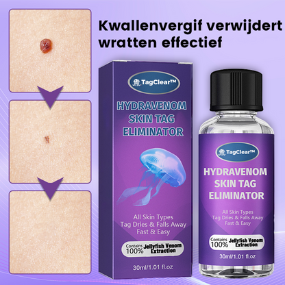 TagClear™ | Huidlabel Verwijderaar