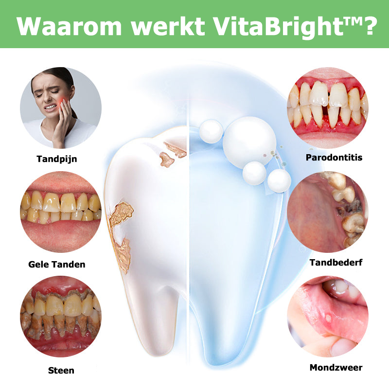 VitaBright™ | Kruiden mondcorrectie en verhelderende mousse