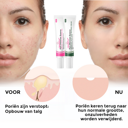 BeautyDuo™ | Pore Minimizer Essence Set Dag- en Nachtcrème