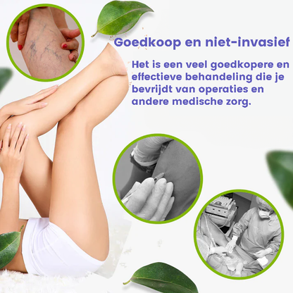 VeinAway™ | Spatadercrème Verwijderaar