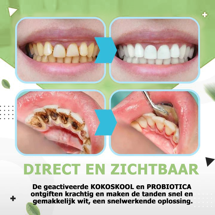 ClearShine™ | Sérum de blanchiment des dents 