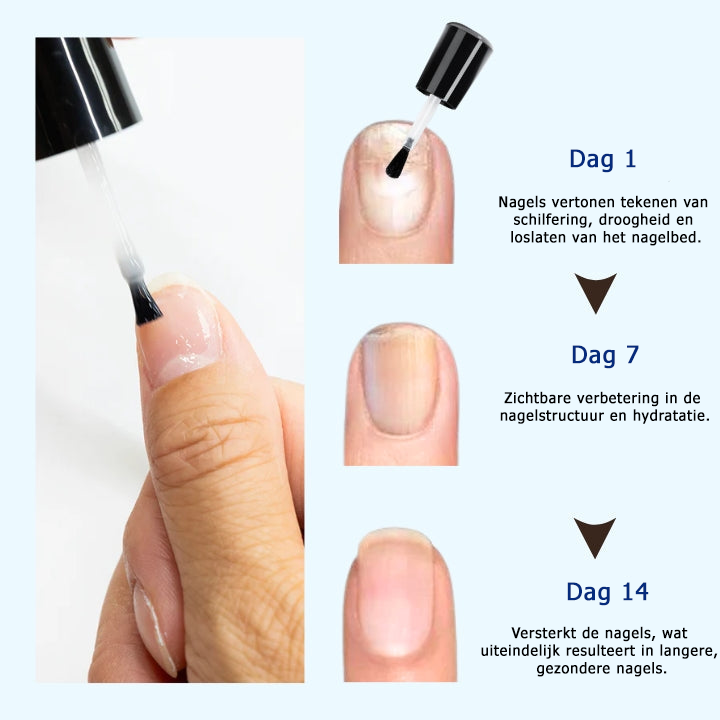 NailSaver™ | Ottieni unghie perfette e sane in soli 7 giorni! 