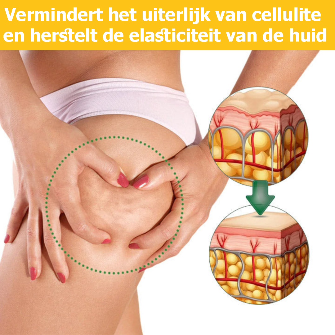 CelluSlim™ | Crema Anticellulite 