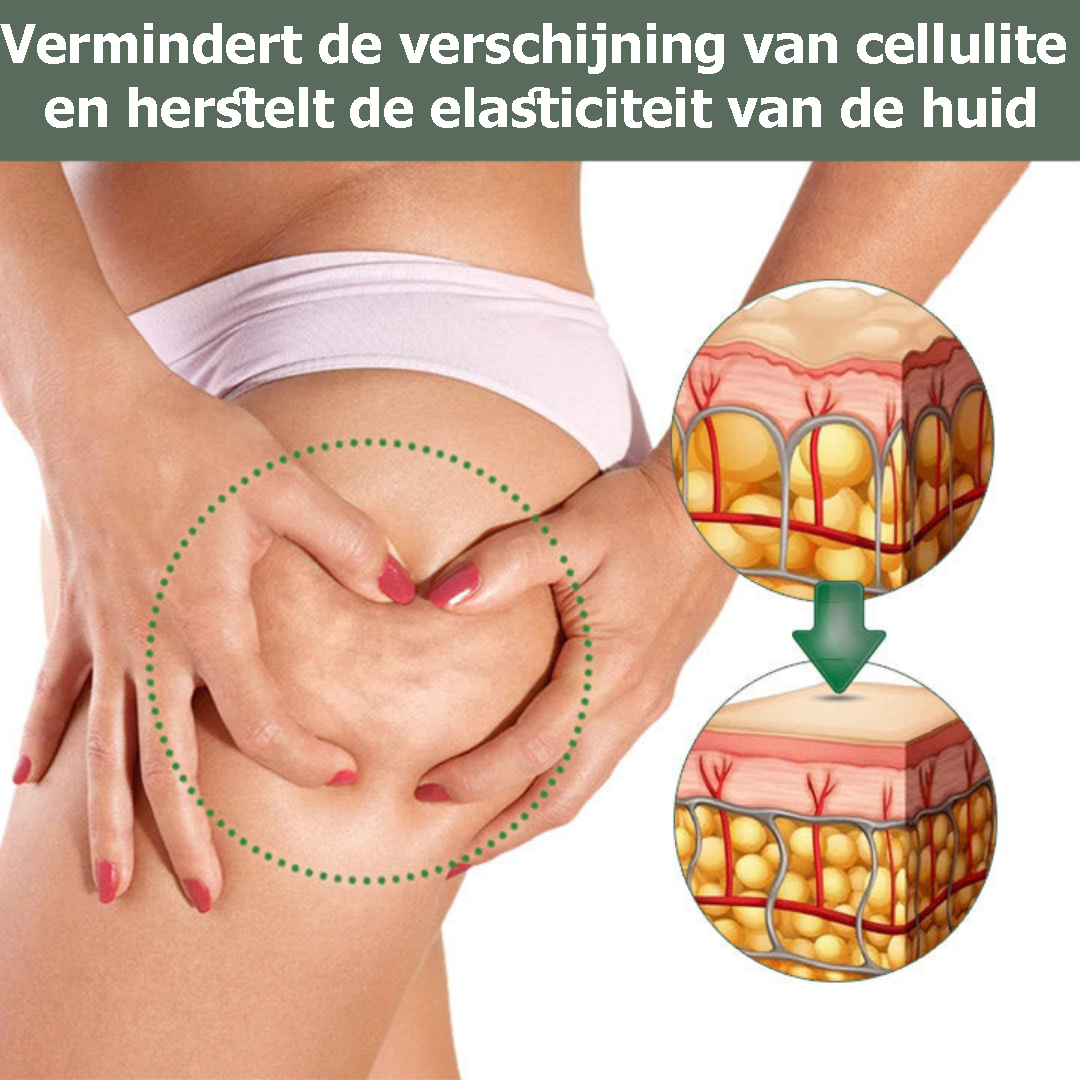 CelluFirm™ | Cellulite éliminée avec une crème raffermissante pour la peau 