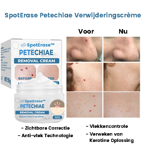 SpotErase™ | Crema per la rimozione delle petecchie 