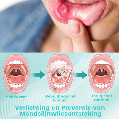 RadiantTeeth™ | Een oplossing voor alle mondproblemen in één spray!