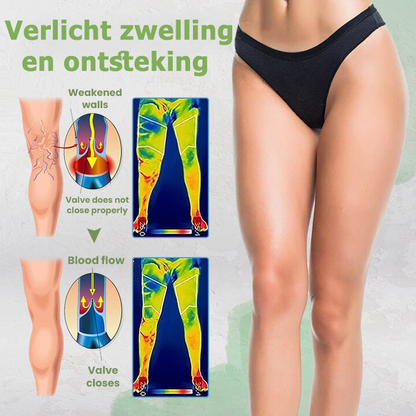 VeinClear™ | Behandeling van aderen en aderen