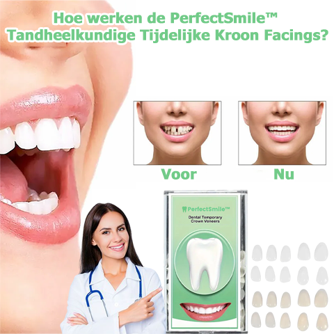 PerfectSmile™ | Faccetta per corone dentali provvisorie 