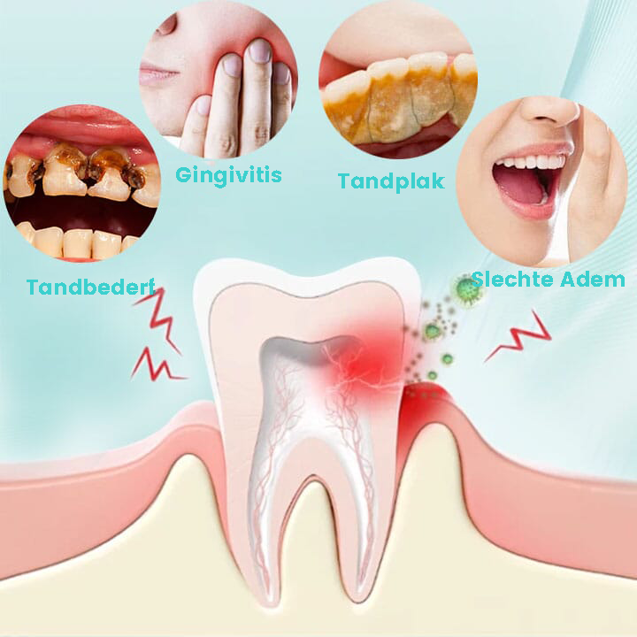 RadiantTeeth™ | Een oplossing voor alle mondproblemen in één spray!