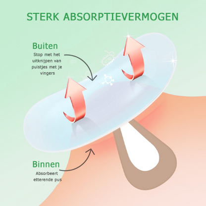 AcnéCure™ | Patchs hydrocolloïdes de traitement de l'acné pour la nuit 