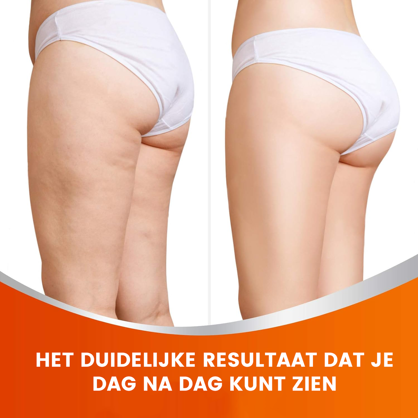 Lifting des fesses™ | Patchs de lifting des fesses 