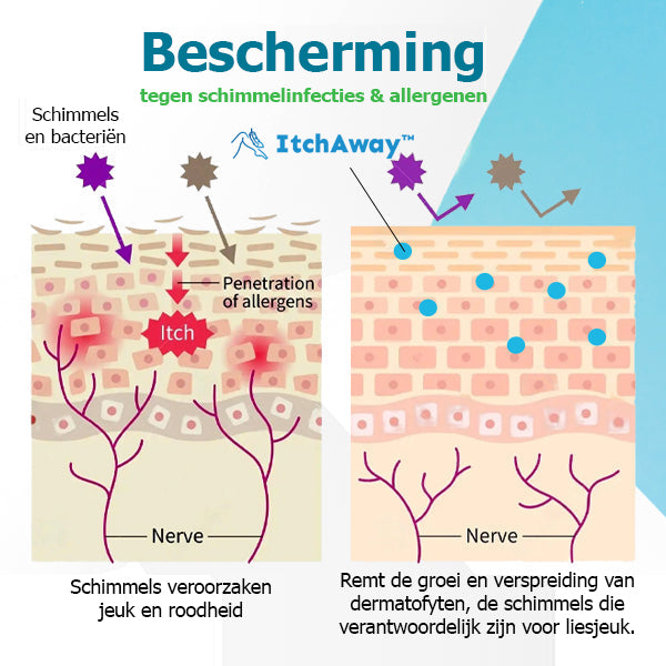 ItchAway™ | Crema fungina per prurito all'inguine 