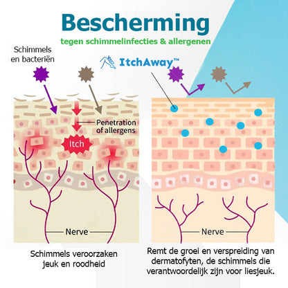 ItchAway™ | Crema fungina per prurito all'inguine 