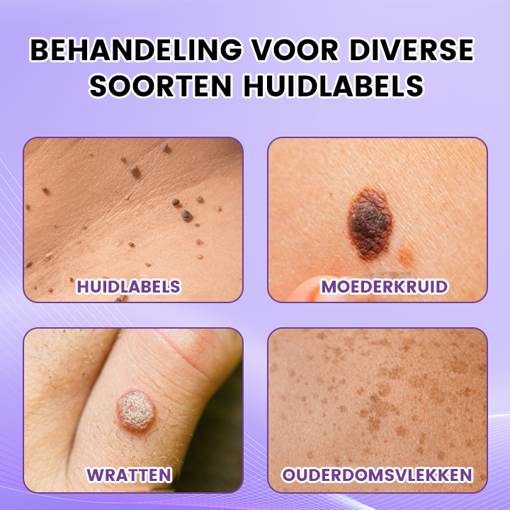 TagClear™ | Huidlabel Verwijderaar