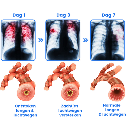 BreathBliss™ | Spray Detergente alle Erbe per le Vie Respiratorie 