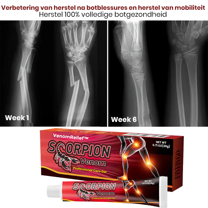 VenomRelief™ | Schorpioenengif Professionele Verzorgingsgel