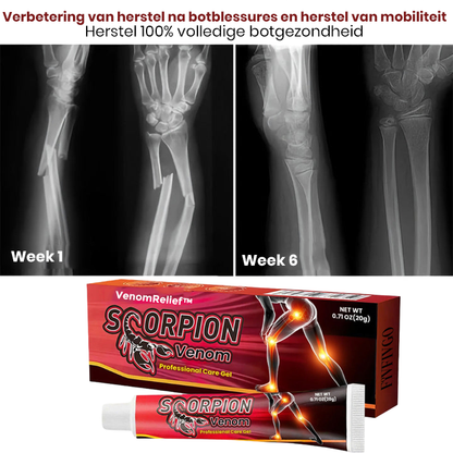 VenomRelief™ | Schorpioenengif Professionele Verzorgingsgel