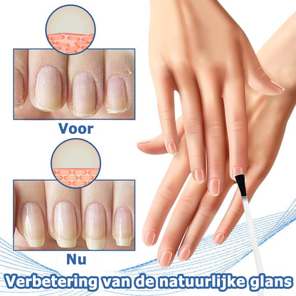 NailFame™ | Vloeistof voor de behandeling van nagelschimmel