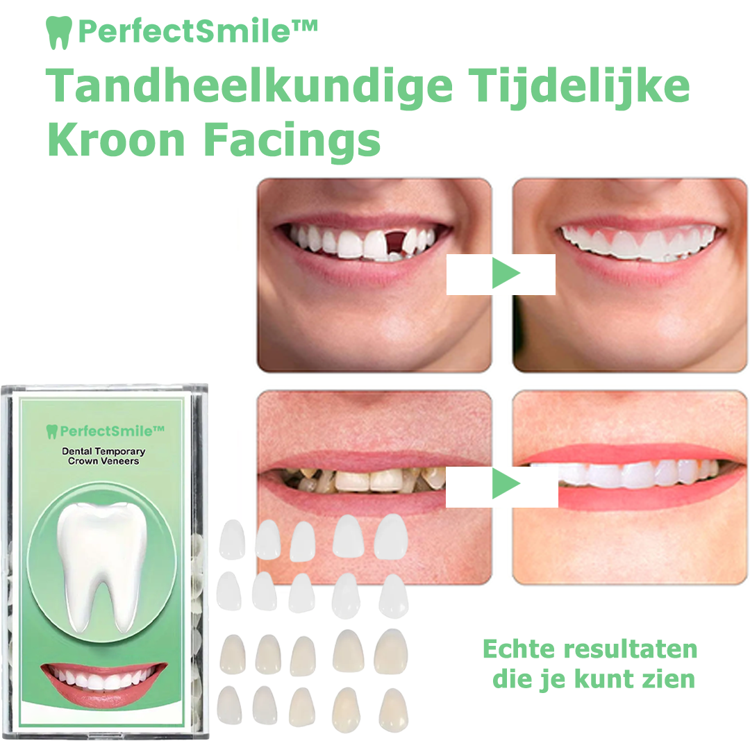 PerfectSmile™ | Faccetta per corone dentali provvisorie 