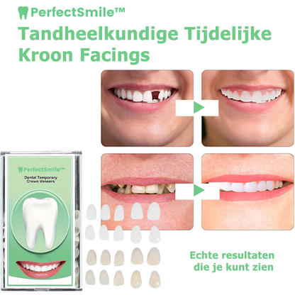 PerfectSmile™ | Facette de couronne dentaire temporaire 