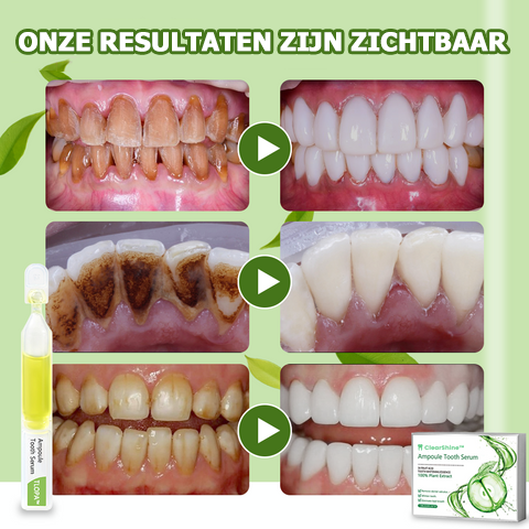 ClearShine™ | Sérum de blanchiment des dents 