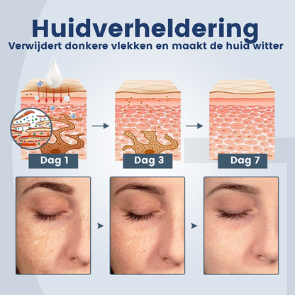 DermSkin™ | Huidverstevigende Lotion