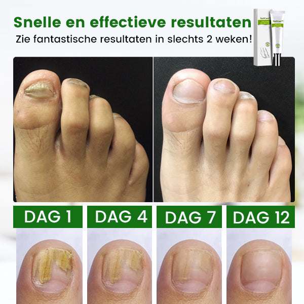 Soins des Ongles™ | Gel de soin des ongles 