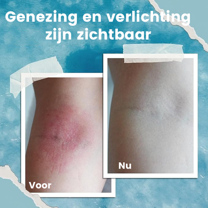 OceanCalm™ | De Ocean Eczema Natuurlijke Verzachtende Crème