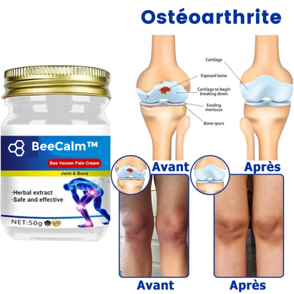 BeeCalm™ | Crema curativa per dolori articolari e ossei con veleno d'api 