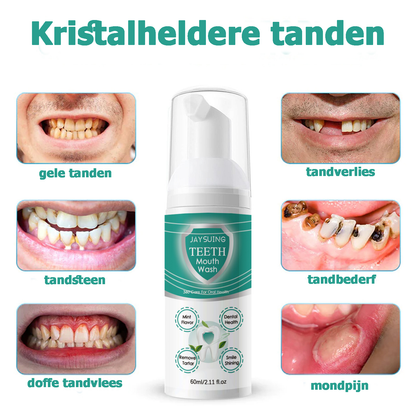 OralCare™ | Water hier voor alle mondproblemen