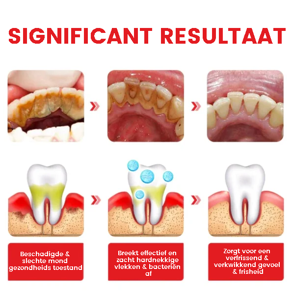 ProBright™ | Dentifrice blanchissant aux probiotiques 