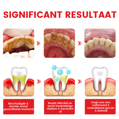 ProBright™ | Probiotische Whitening Tandpasta