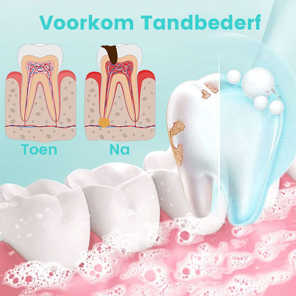 RadiantTeeth™ | Een oplossing voor alle mondproblemen in één spray!