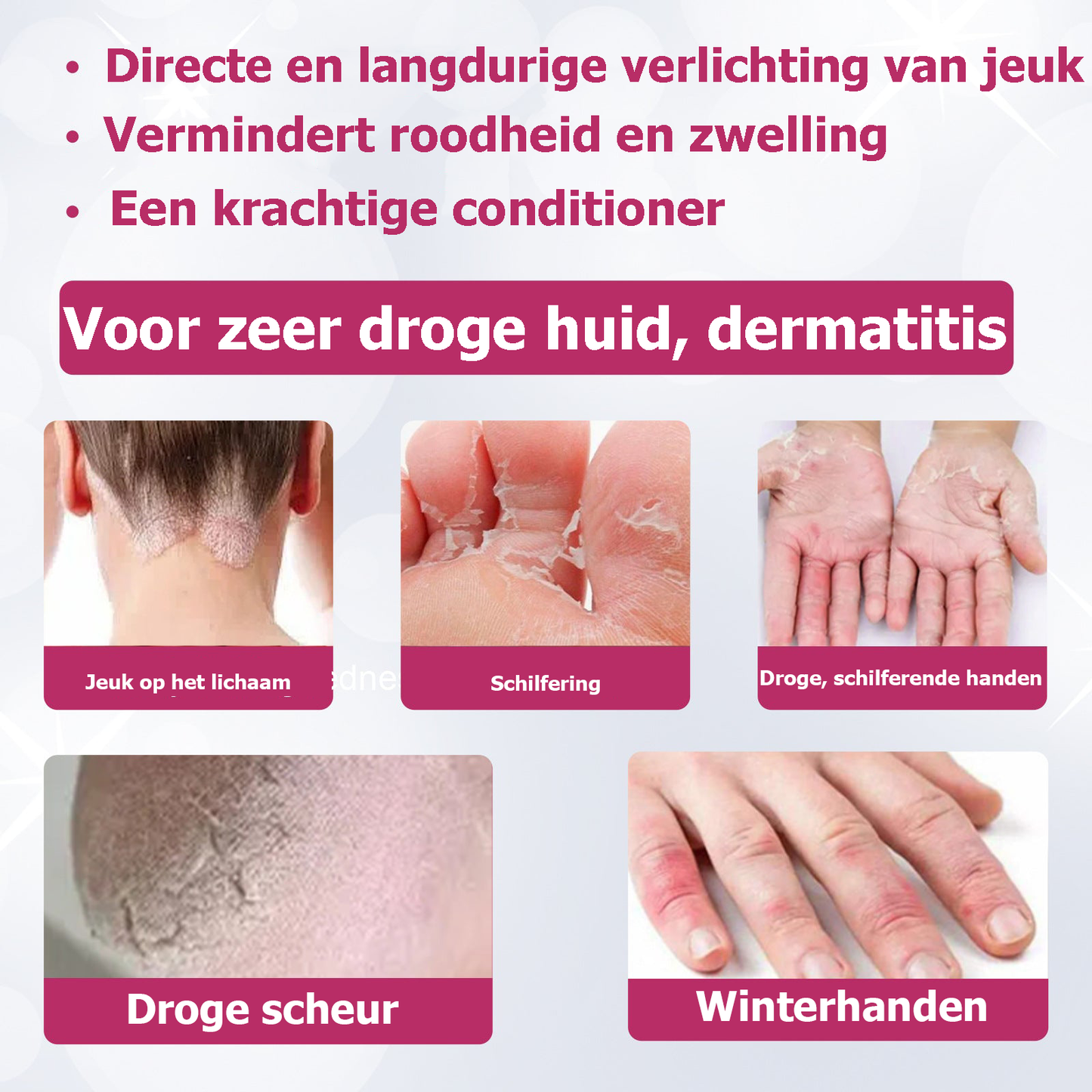 ItchyStop™ | Crème voor de behandeling van multi-symptomatische psoriasis