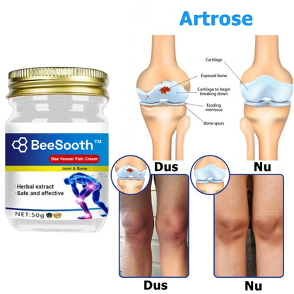 BeeSooth™ | Crème médicinale contre les douleurs articulaires et osseuses au venin d'abeille 