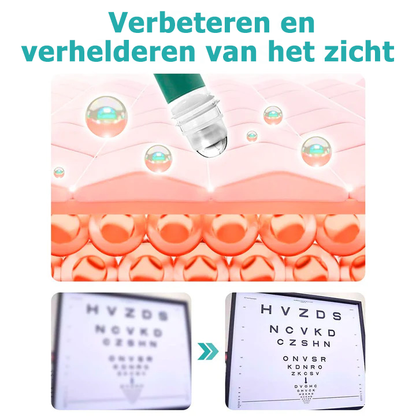 Eyevolve™ | Oogcirkel om het zicht te verbeteren