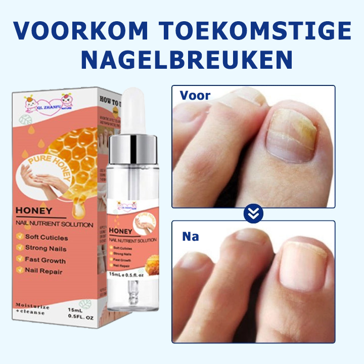 NailSaver™ | Krijg perfecte en gezonde nagels in slechts 7 dagen!