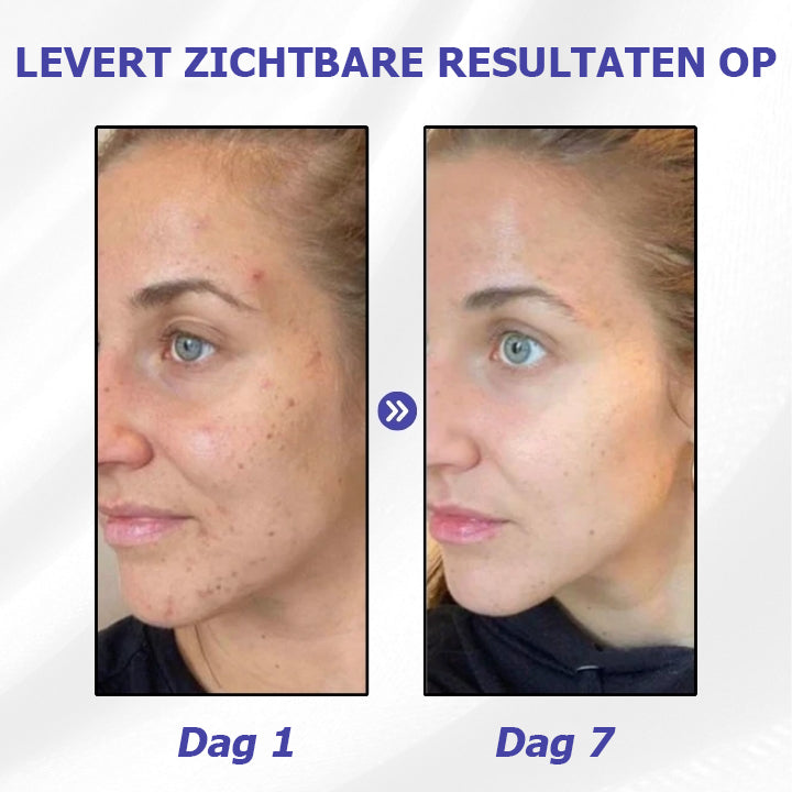 BrightSkin™ | Vlekkeloze Stralende Vlekken Crème