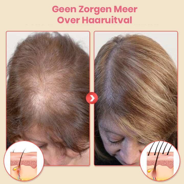 VitaHair™ | Schuimende Shampoo voor Haarregeneratie