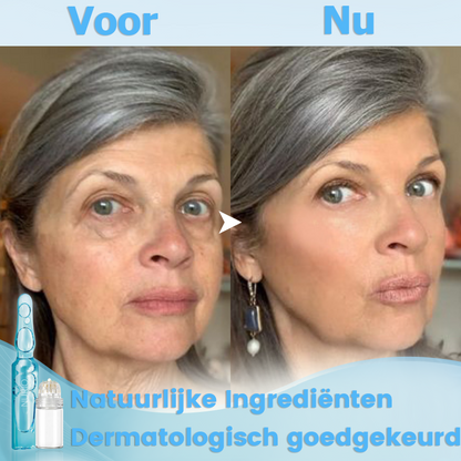 FirmLift™ | Micro-infusiesysteem voor punctie met anti-aging serum