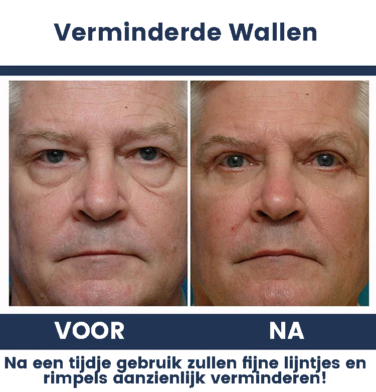 LookYounger™ | Anti-Aging Oogcrème voor Mannen