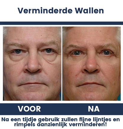 LookYounger™ | Anti-Aging Oogcrème voor Mannen