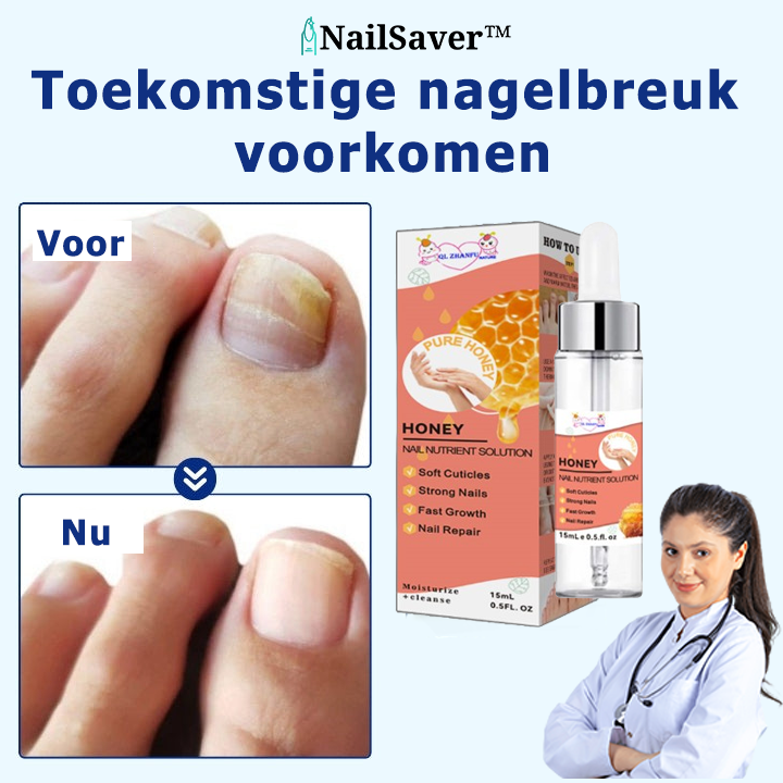 NailSaver™ | Krijg perfecte en gezonde nagels in slechts 7 dagen!